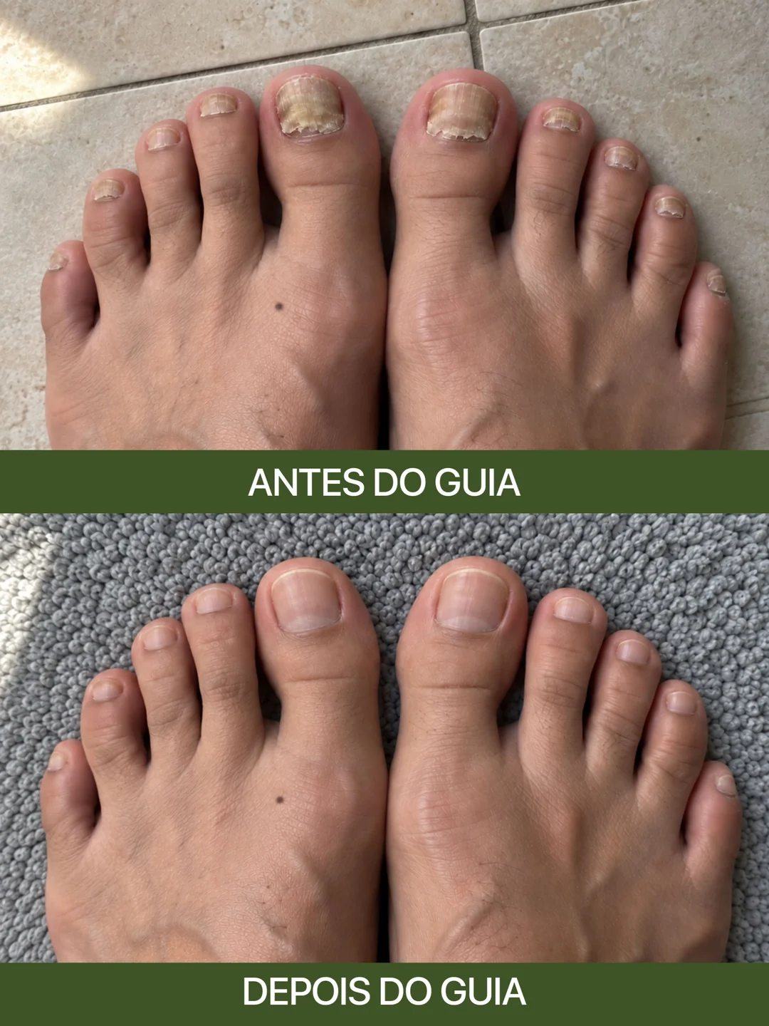 Cuidados naturais com a pele